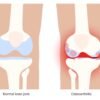 best orthopeadics near me