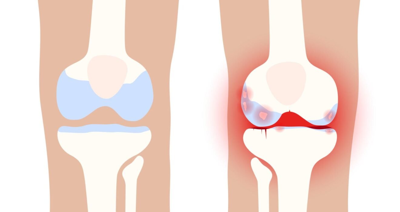 best orthopeadics near me