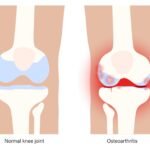 best orthopeadics near me
